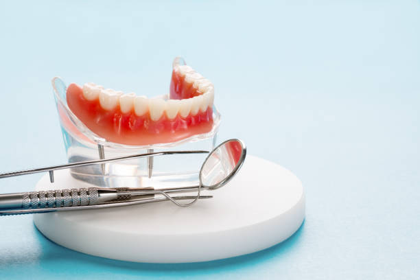Dental Bonding in Picnic Point, WA